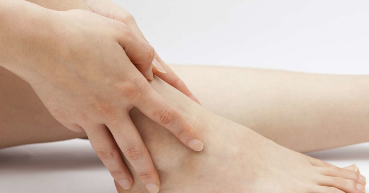 itchy-ankles-causes-rash-and-treatment