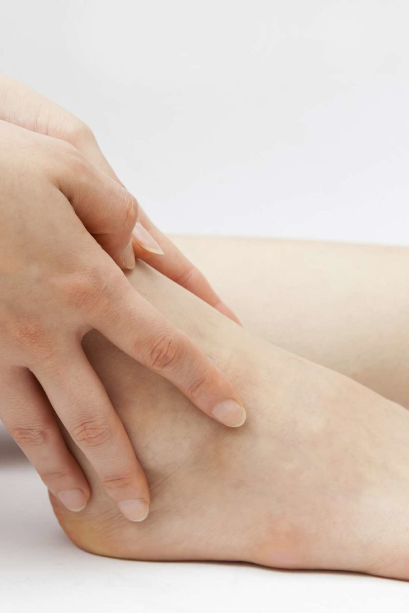 Itchy Feet: Causes, Symptoms, and Treatments, Per Doctors
