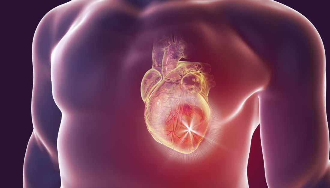 Gout drug could help treat heart failure