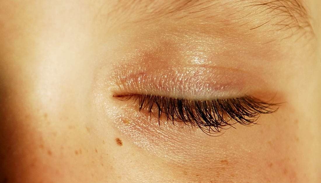 causes-of-eye-twitching-for-weeks-lwmups