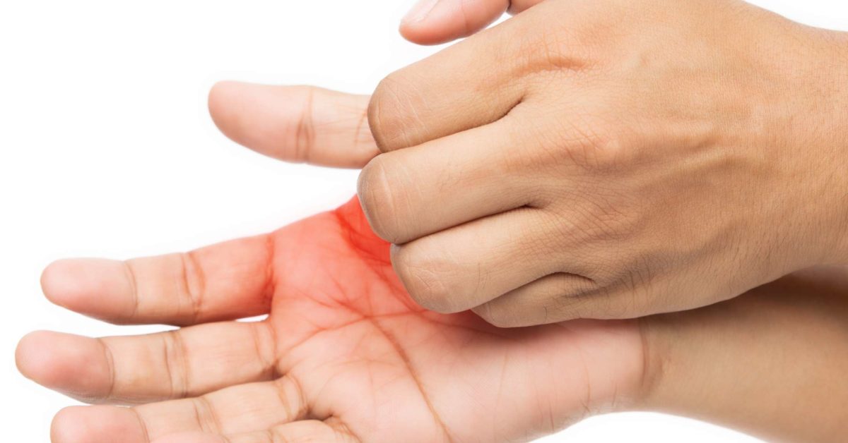 itchy-palms-6-causes-treatment-and-prevention