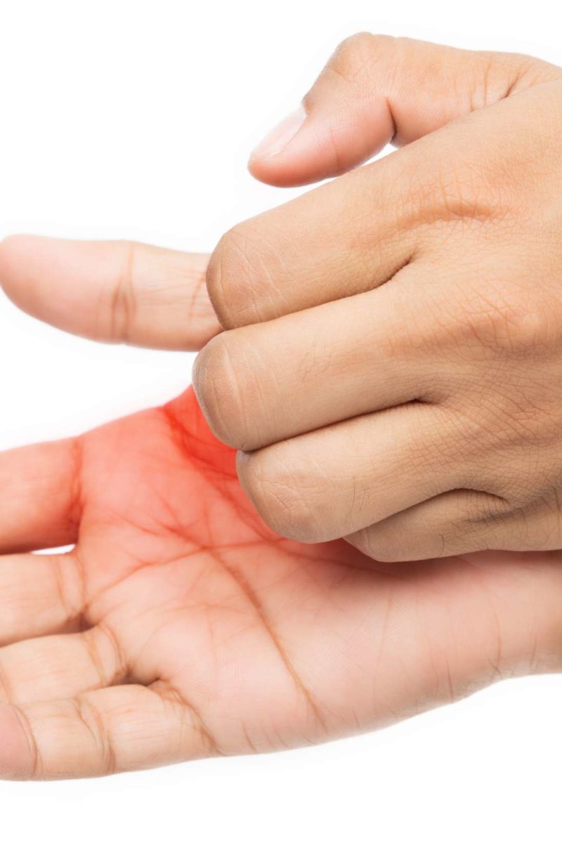 Itchy palms 6 causes, treatment, and prevention