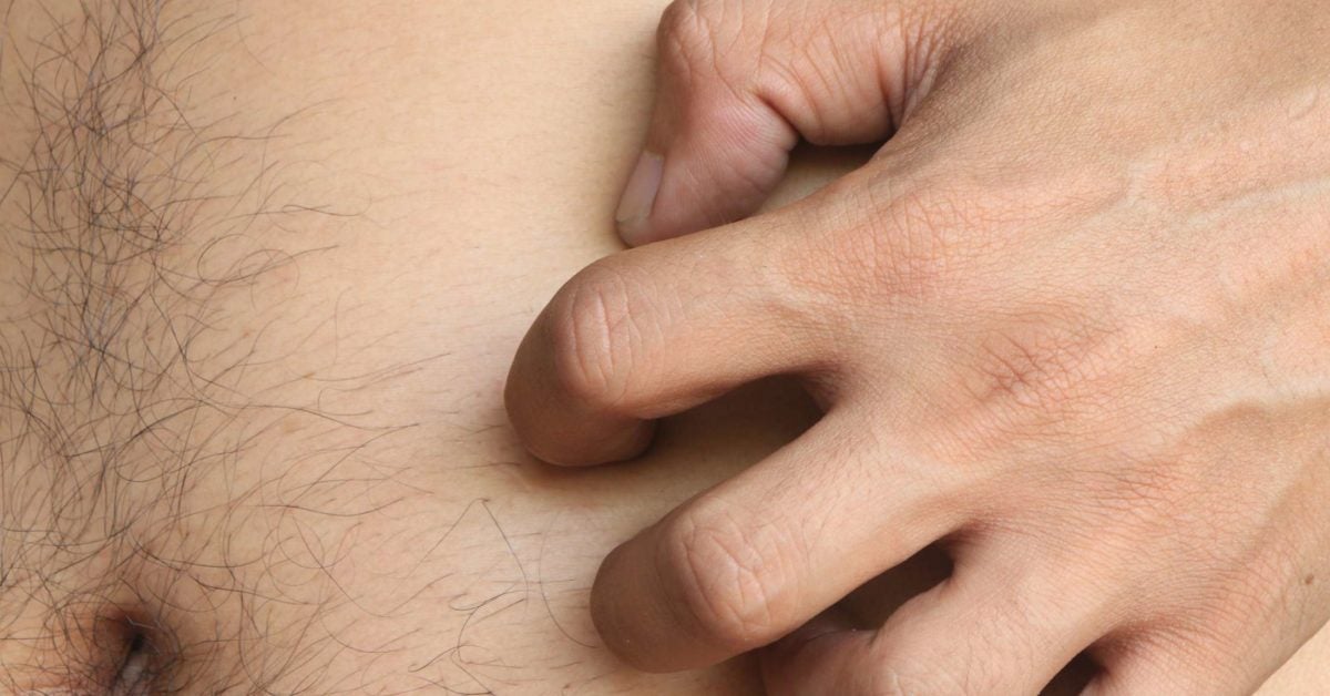 Itchy stomach: Causes, symptoms, and treatment