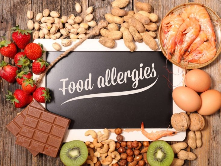 Can You Randomly Develop A Food Allergy