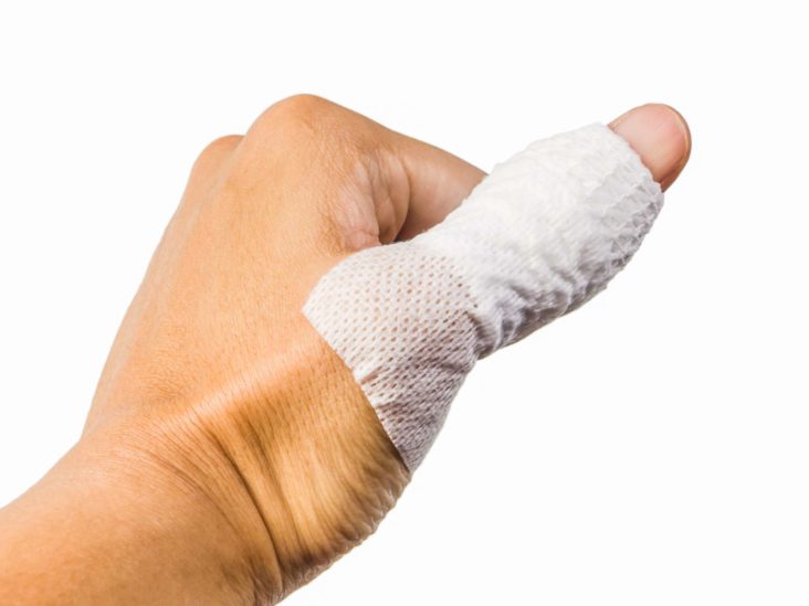 thumb fracture treatment