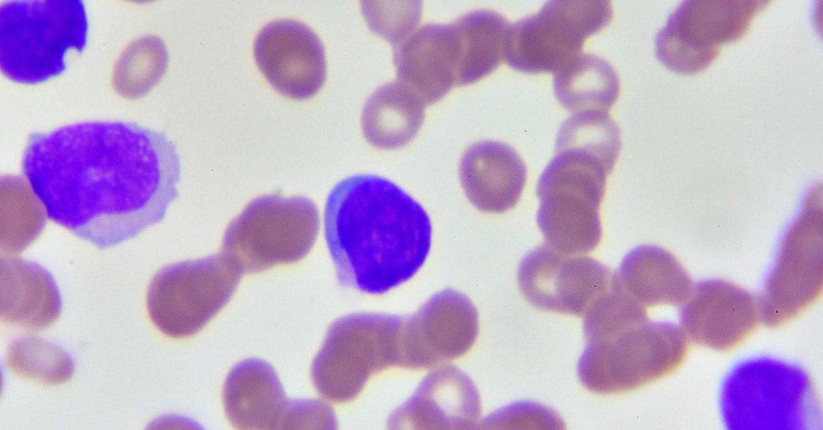 Absolute Basophils High Count at James Duval blog