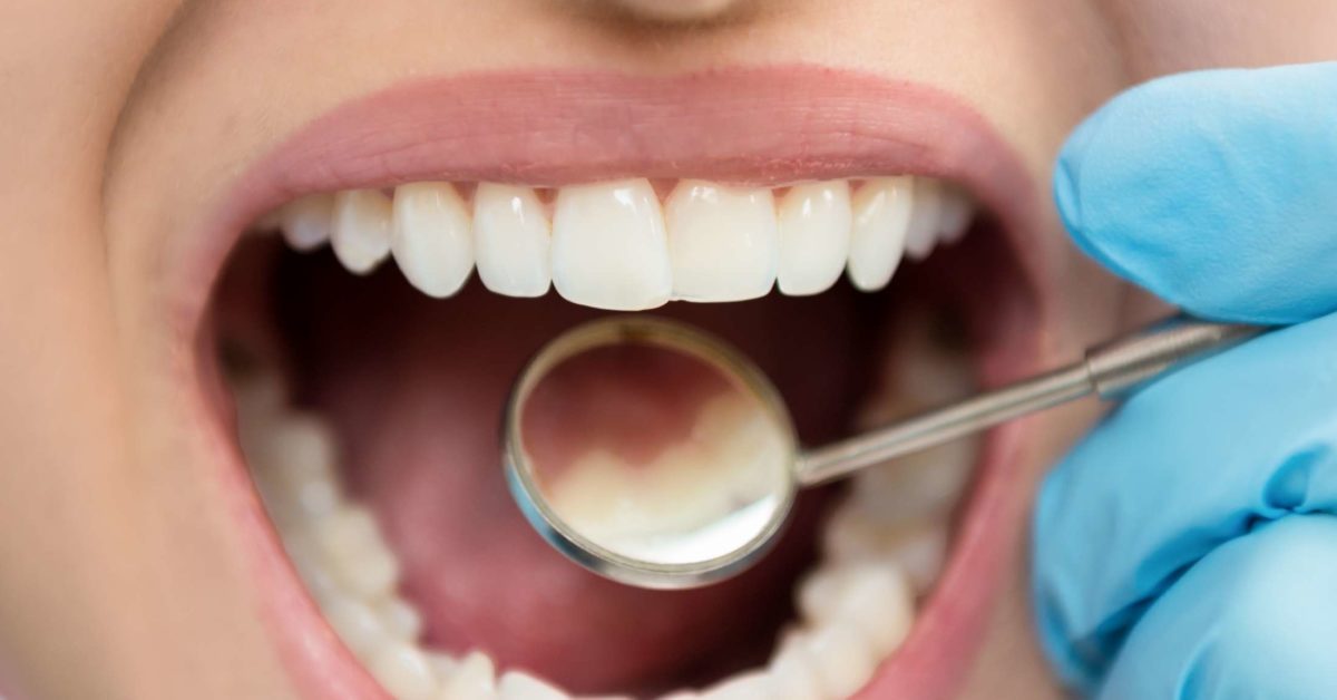 Почему открывают зуб. Стоматология профилактическая.