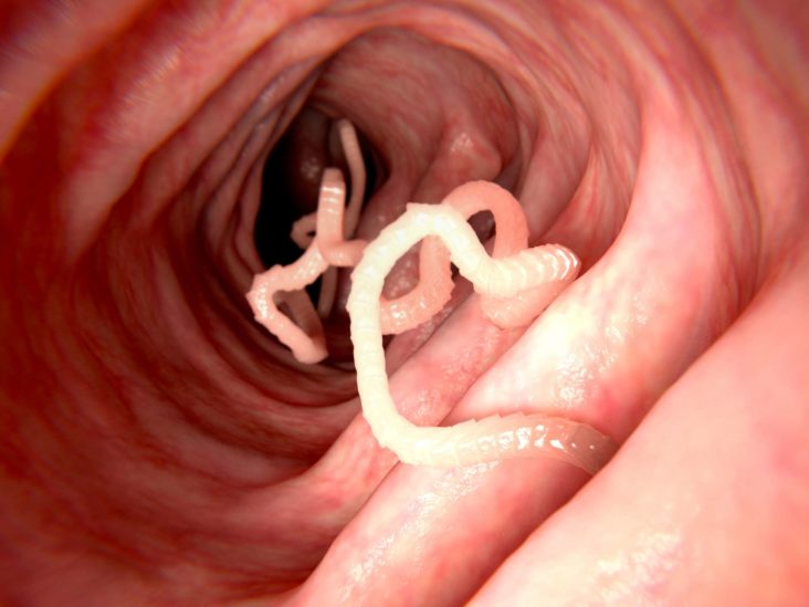 Tapeworms: Causes, symptoms, and treatments