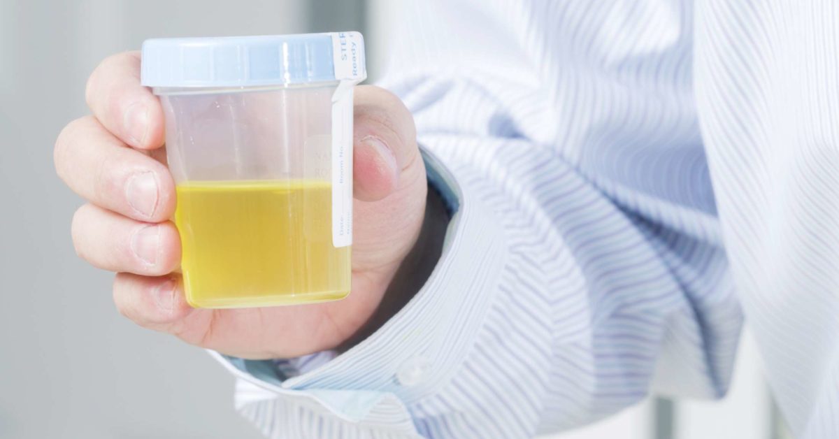 Mucus in Urine: What's Causing It?