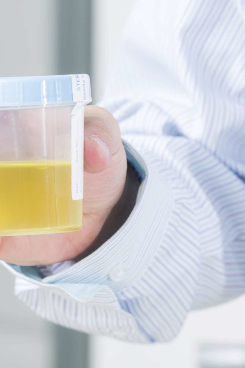 cells in urine: Test types, and causes