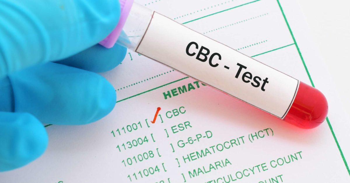 What Is Mch On A Cbc Blood Test