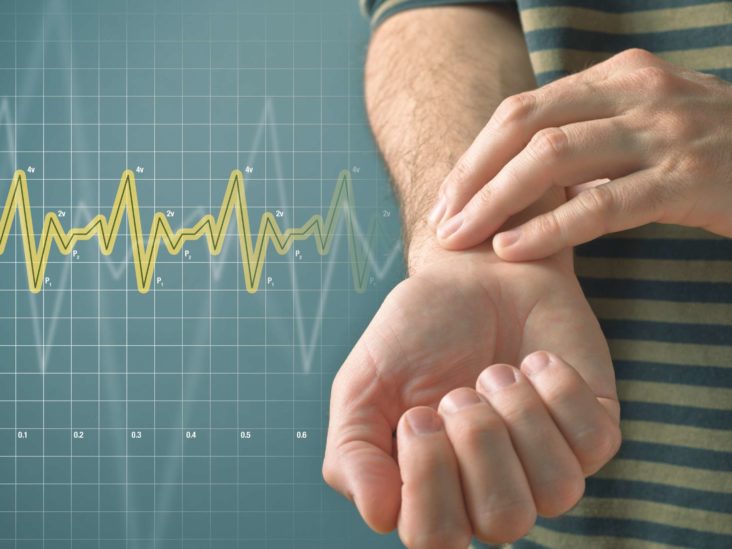 salvar ganador evitar Bradicardia o frecuencia cardíaca lenta: cuándo consultar a un médico