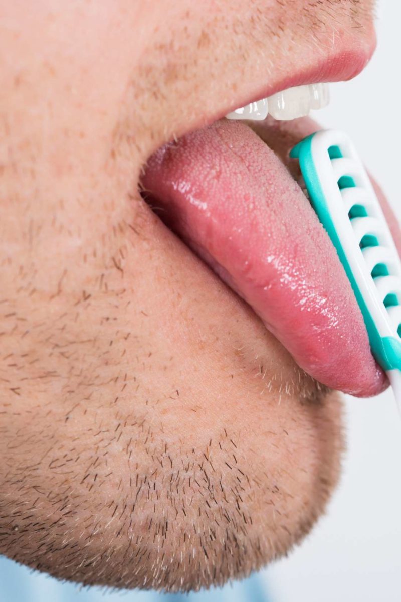 oral thrush tongue treatment