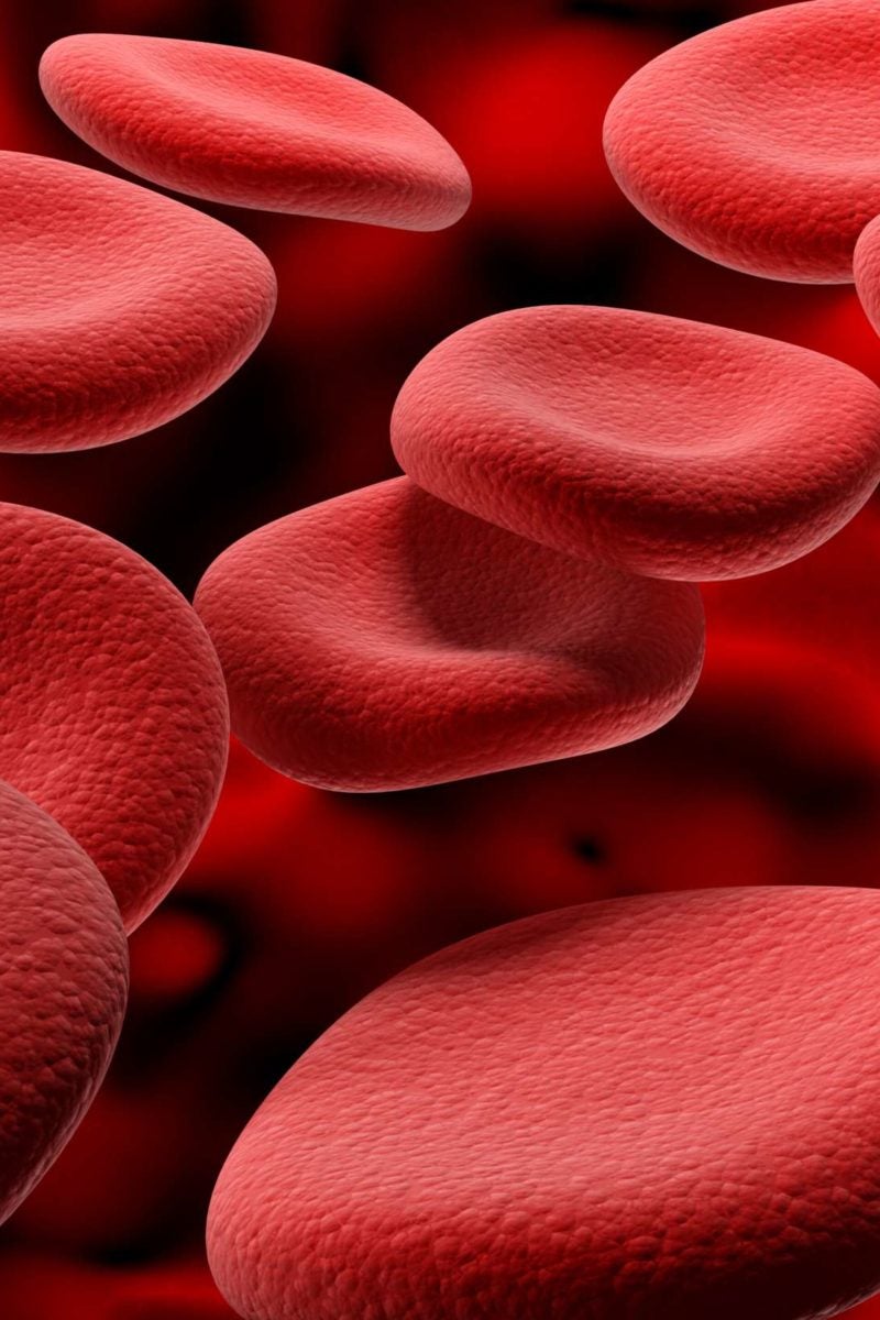 doble Oriental toque Cómo aumentar la hemoglobina: Alimentos y remedios caseros