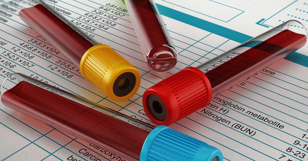 Red cell distribution width (RDW) blood test: What is it?