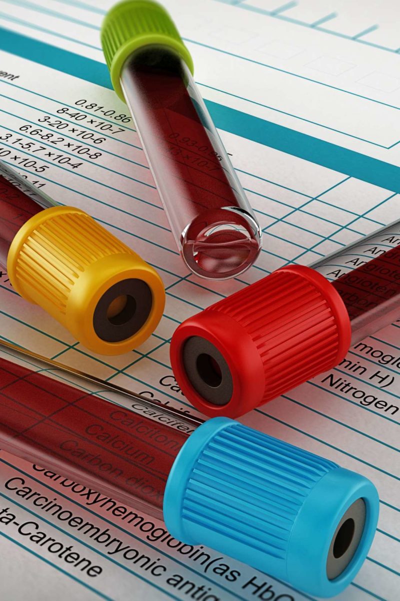 Red Cell Distribution Width RDW Blood Test What Is It 