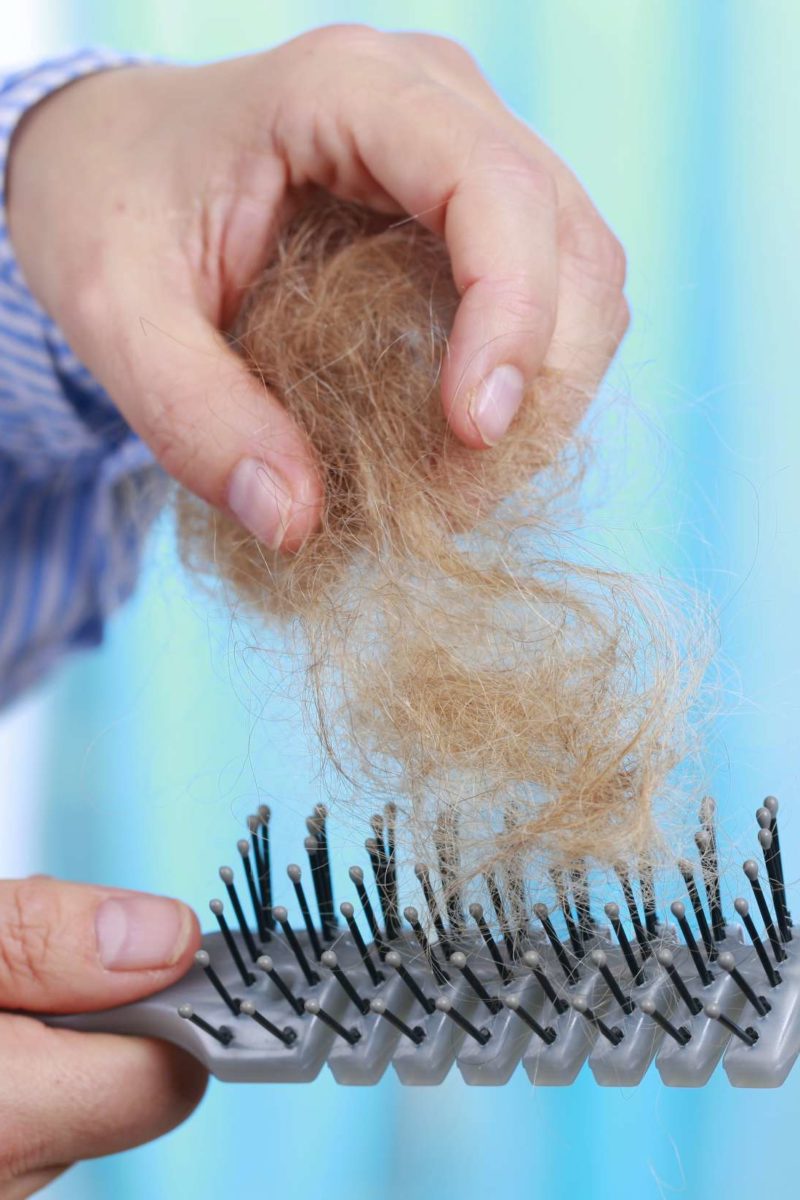 Hair Shedding 8 Simple Ways to Control It  Reduce Hair LossHairlust