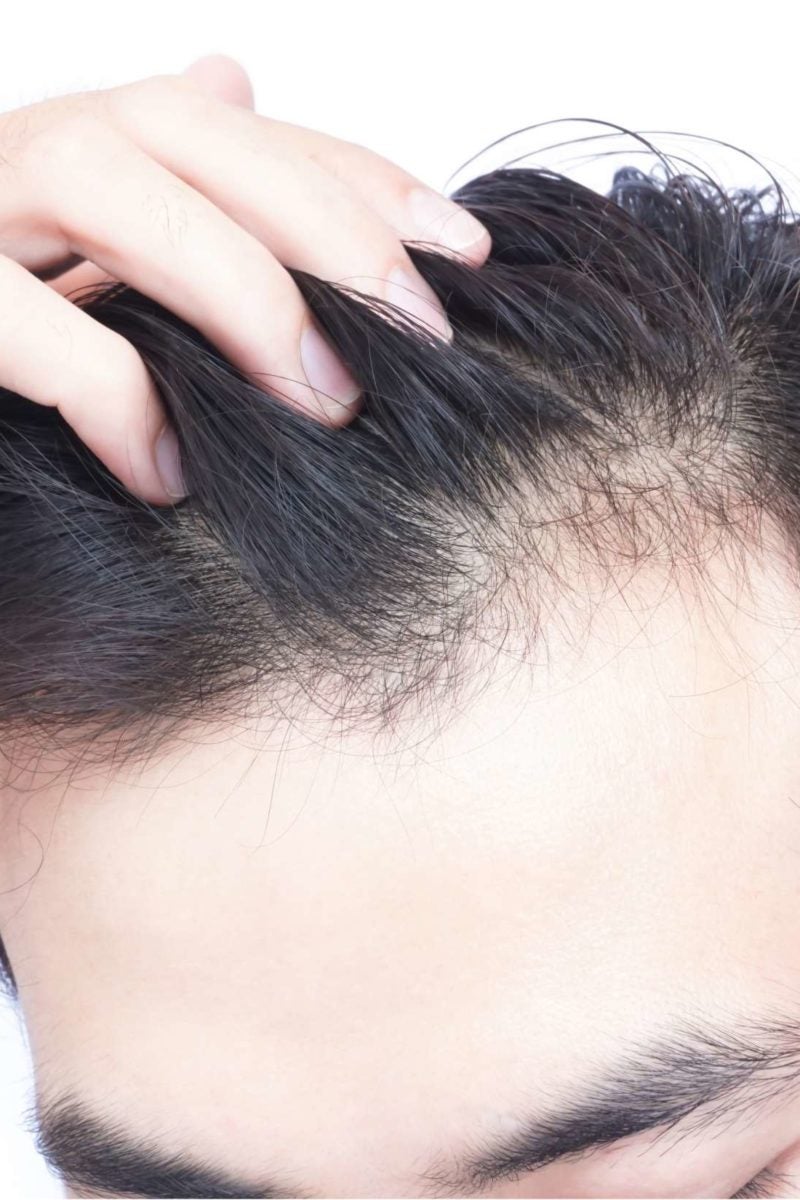 hair loss after covid treatment