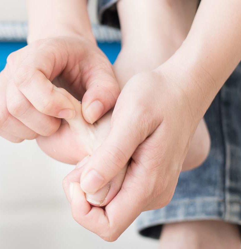 At dræbe sende kvalitet Skin peeling between toes: Causes and treatment