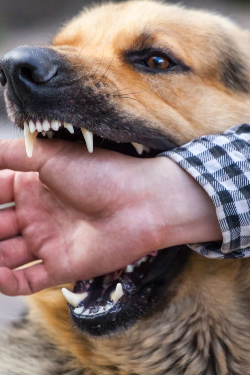 what happens when a dog bites a person