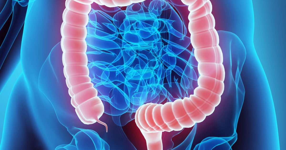 Could gut bacteria drive colon cancer?