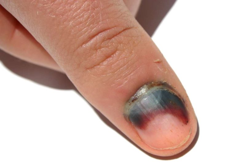 Nail health chart: Common problems and how to treat them