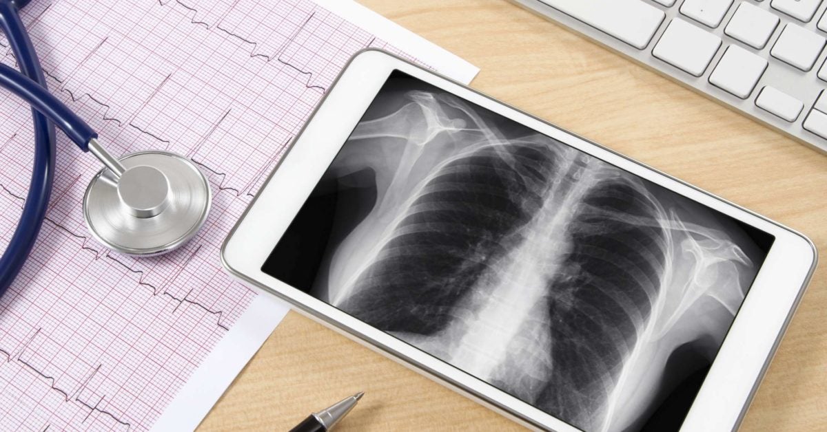 centrilobular-emphysema-diagnosis-treatment-and-outlook