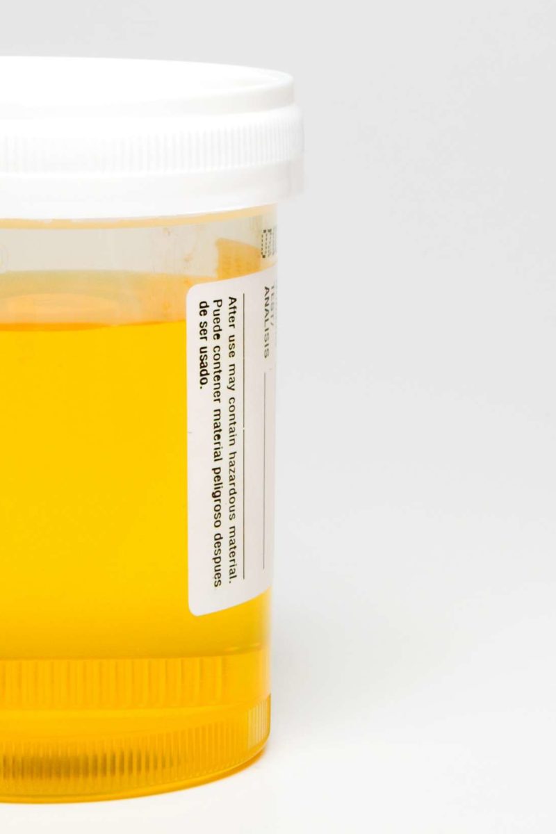 what causes diluted urine in dogs