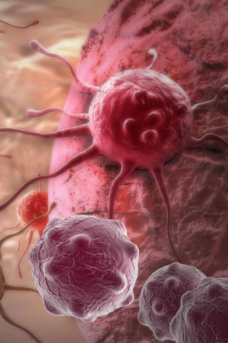 Can this new discovery help us to eliminate brain cancer?