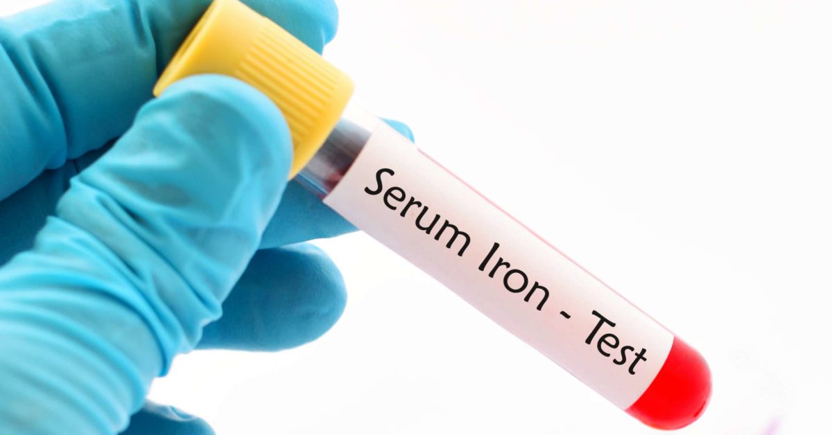 Serum iron test: Procedure, results, and normal ranges Serum Iron Test: Procedure, Results, And Normal Ranges