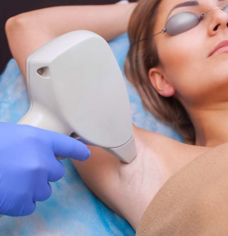 Is laser hair removal permanent, and is it safe?