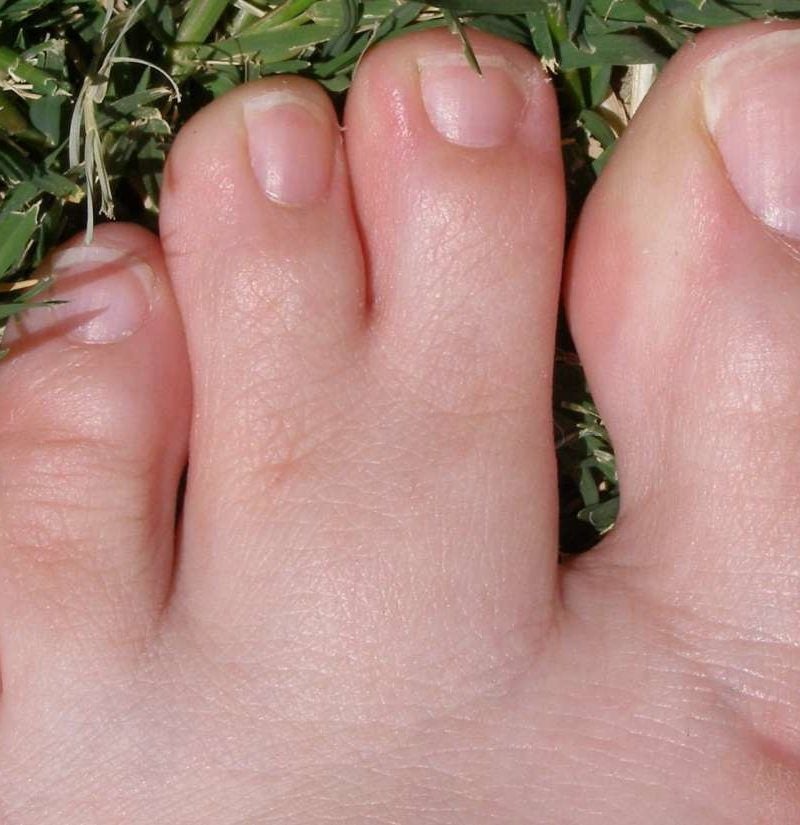 Long Second Toe