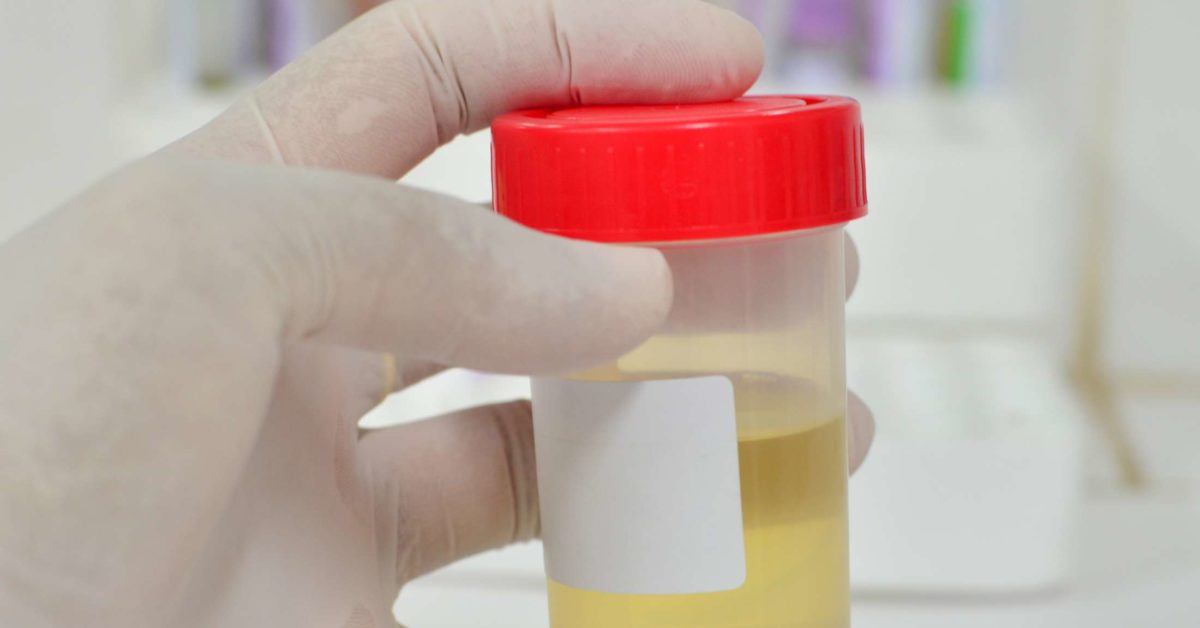 normal specific gravity of urine