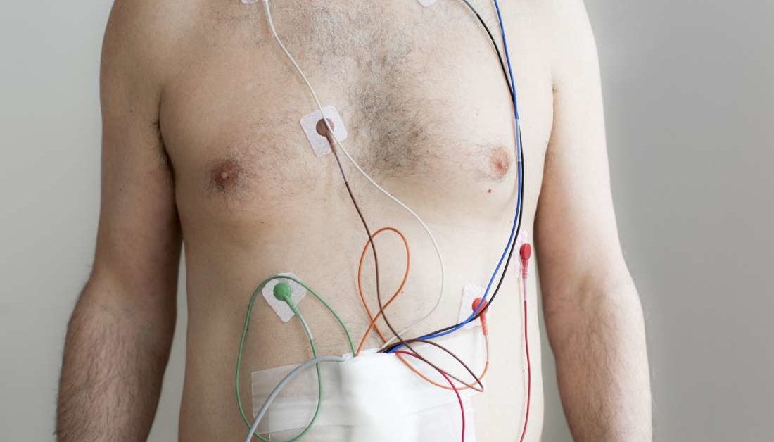 cardiac monitor lead placement