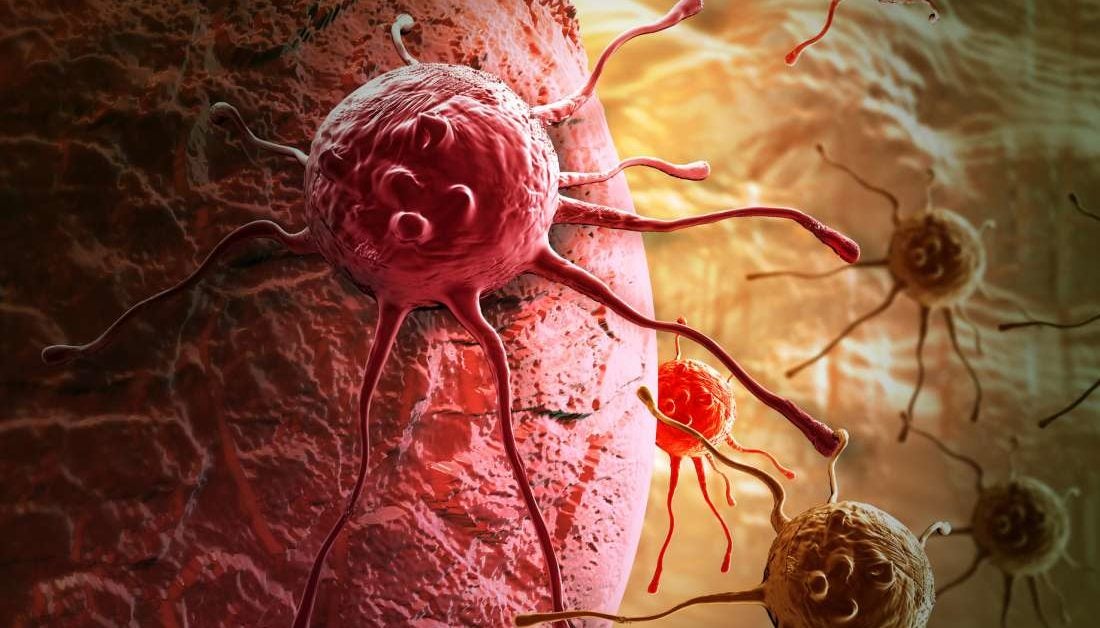 New 'potential target' for cancer therapy found