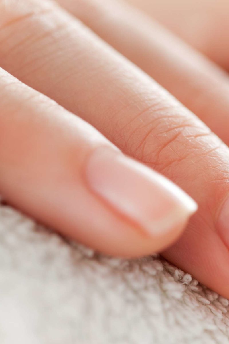 peeling-nails-causes-treatment-and-prevention