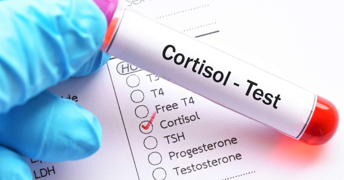 Cortisol Test (stress hormone): Test cortisol levels from home