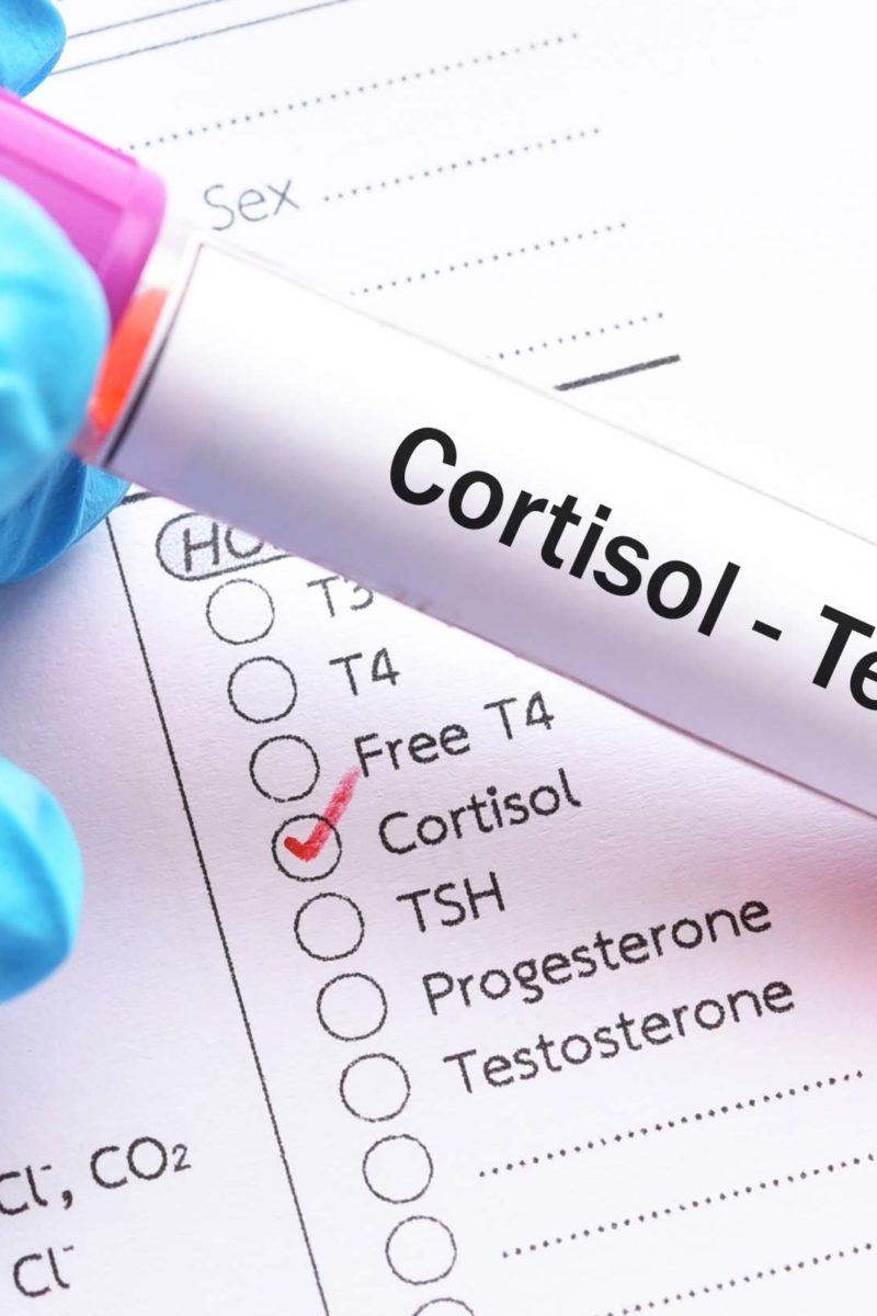 Cortisol Level Test Purpose Procedure And Results