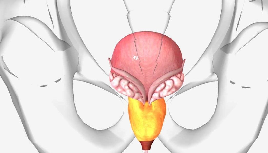 prostate enlargement stages)