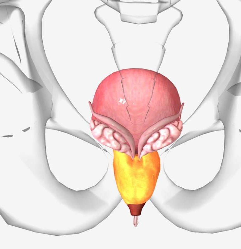 enlarged prostate gland