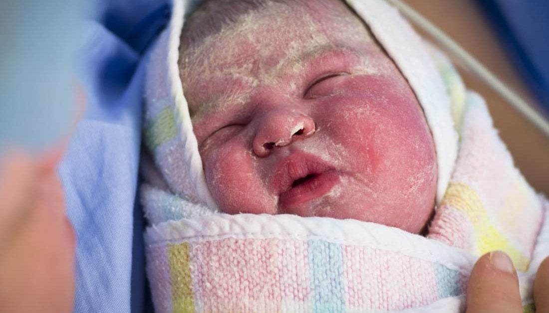 baby born with white stuff