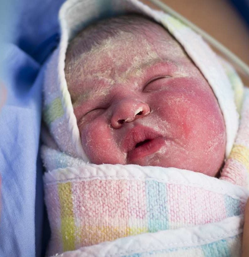 Newborn skin peeling: Causes, treatment, and home remedies