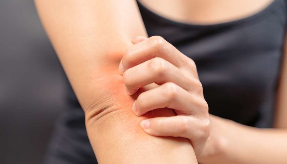 What Serious Medical Conditions Cause Itching