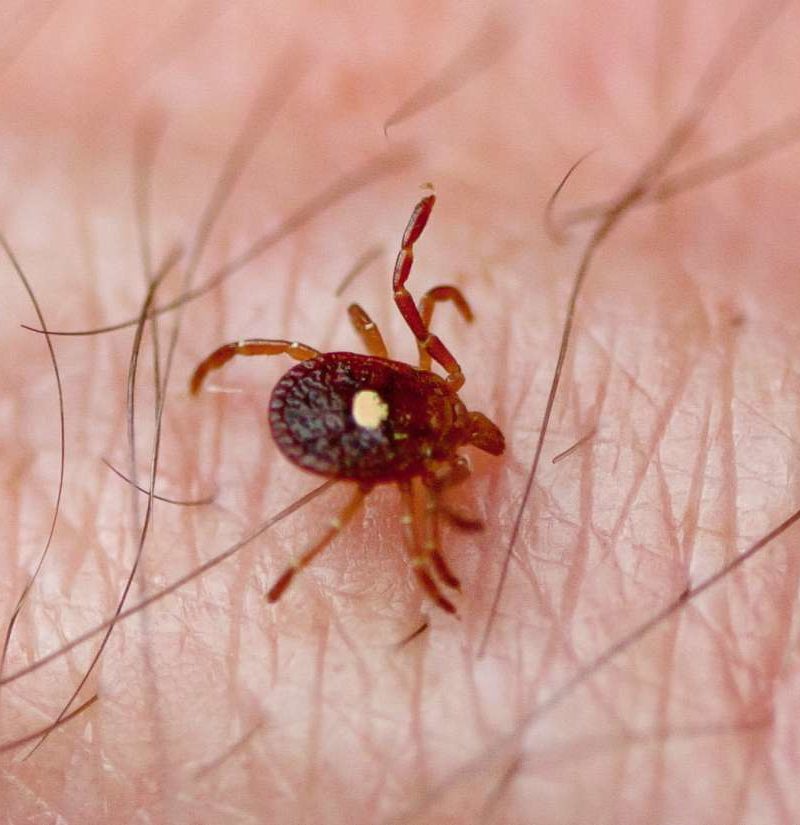 Meat allergy from tick bite A common cause of anaphylaxis?