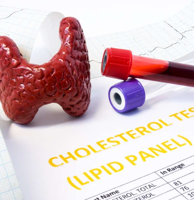 Thyroid problems and cholesterol What's the link?