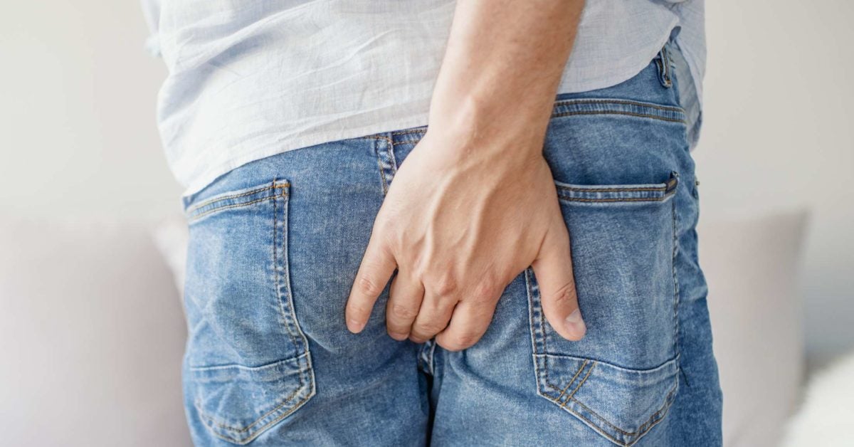 External Hemorrhoids Causes Symptoms And Treatments