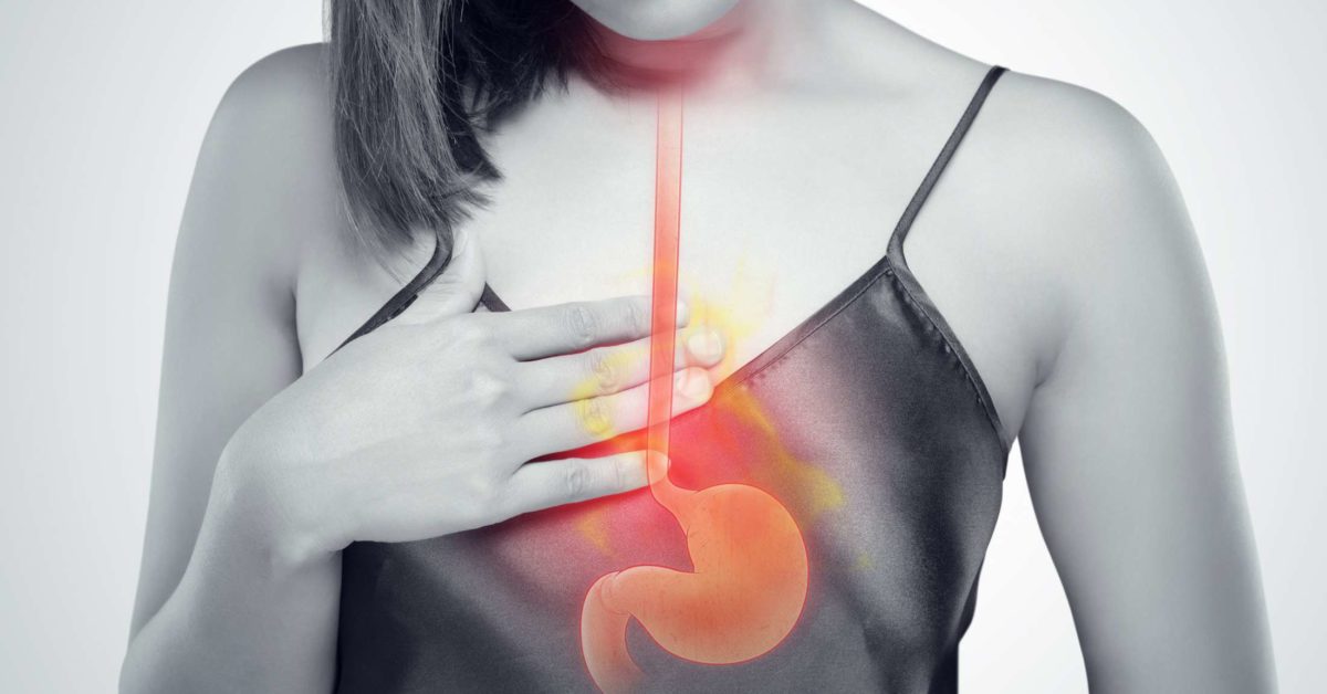 Heartburn, acid reflux, and GERD: What's the difference?