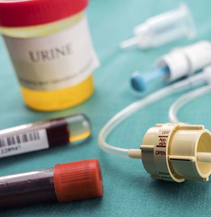 Urea dysfunctions in the liver may signal cancer