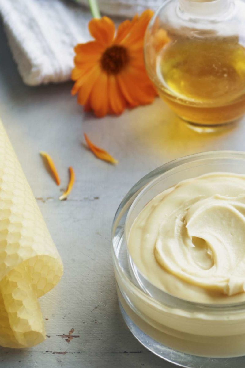 How to prevent stretch marks 10 ways