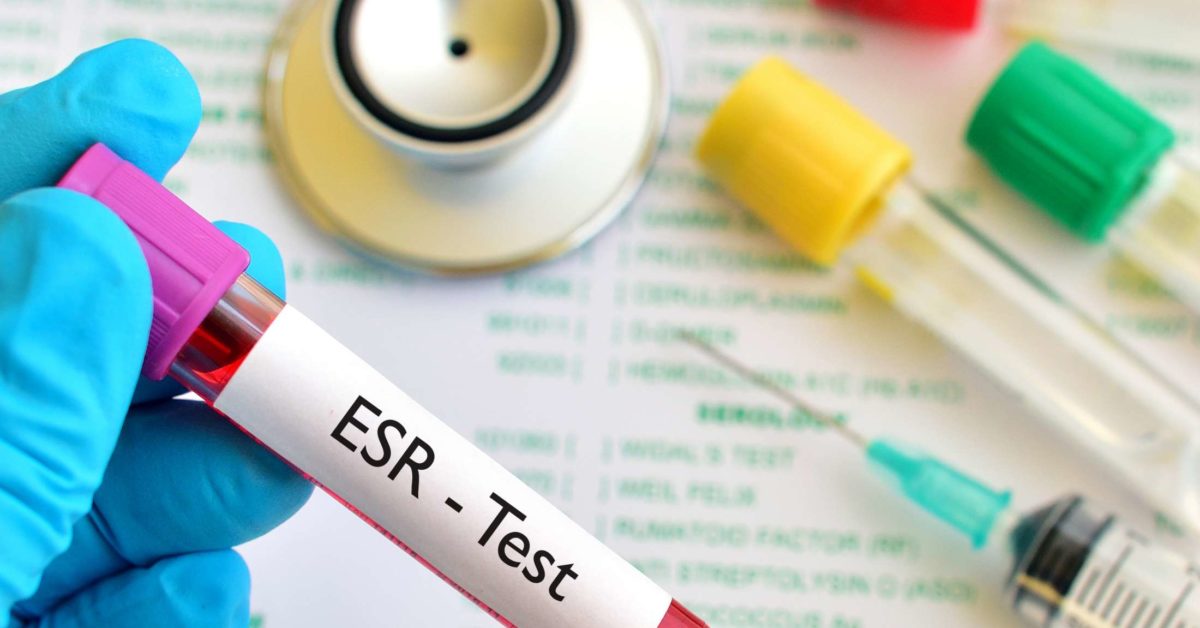 What Is Esr In Blood Test High